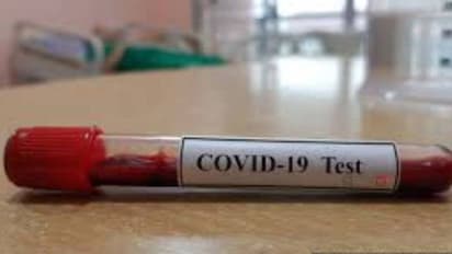 കൊവിഡ് 19: മരിച്ചയാളുടെ ബന്ധുക്കളുടെ അഭിമുഖമെടുത്ത മാധ്യമപ്രവര്‍ത്തകര്‍ നിരീക്ഷണത്തിൽ