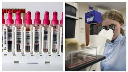 কোন ব্লাড গ্রুপে করোনা সংক্রমণের সম্ভাবনা সবচেয়ে বেশি, গবেষণায় উঠে এল চাঞ্চল্যকর তথ্য