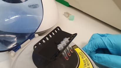 കൊവിഡ് 19: അരമണിക്കൂറിനുള്ളിൽ രോഗനിർണയം നടത്താം; പുതിയ പരിശോധനയുമായി ഗവേഷകർ