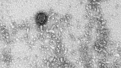 കൊറോണ വൈറസിന്റെ ജനിതക ഘടന കണ്ടെത്തി; റഷ്യൻ അധികൃതർ ചിത്രങ്ങൾ പുറത്തുവിട്ടു