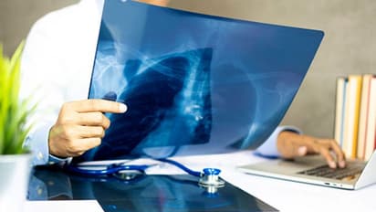 ಕ್ಷಯರೋಗಿಗಳ ಮಾಹಿತಿ ನೀಡಿದವರಿಗೆ 500 ಪೋತ್ಸಾಹ ಧನ