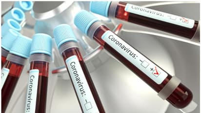 കൊവിഡ് 19: പത്തനംതിട്ടയില് നിരീക്ഷണത്തിലുള്ള വീടുകള്ക്ക് മുന്നില് നോട്ടീസ് പതിക്കും