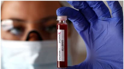 കൊവിഡിനെ അതിജീവിച്ചവരുടെ രക്തം രോഗികൾക്ക്; ഉരുത്തിരിയുമോ ആ മരുന്ന്?