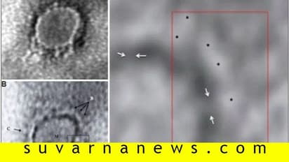 ಭಾರತದ ಮೊತ್ತ ಮೊದಲ ಸೋಂಕಿತನ ಕೊರೋನಾ ವೈರಸ್ ಚಿತ್ರ ಬಿಡುಗಡೆ!