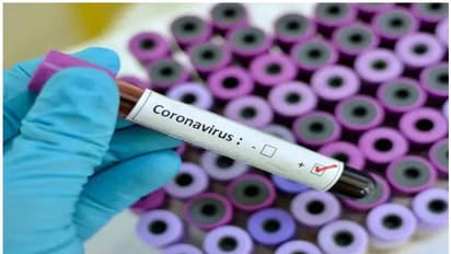 വാർത്ത സമ്മേളനത്തിൽ പങ്കെടുത്തു, കൊവിഡ് സ്ഥിരീകരിച്ച മാധ്യമപ്രവർത്തകനെതിരെ കേസെടുത്തു