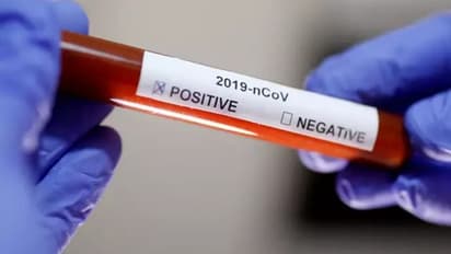 சென்னை மேற்கு மாம்பல இளைஞருக்கு கொரோனா.. தமிழகத்தில் 42ஆக உயர்ந்த கொரோனா பாதிப்பு