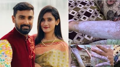 క్రికెటర్ ఇంట్లో పేలిన సిలిండర్...భార్యకు గాయాలు