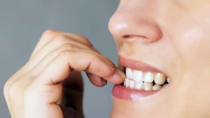 ನೀವೂ ಉಗುರು ಕಡಿತೀರಾ? ಆರೋಗ್ಯ ಹಾಳ್ಮಾಡುವ ಚಟಕ್ಕೆ ಹೇಳಿ ಗುಡ್ ಬೈ