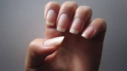 ಉಗುರಿನ ಬಣ್ಣದಿಂದಲೇ ಶ್ವಾಸಕೋಶದ ಕಾಯಿಲೆಯೂ ಗೊತ್ತಾಗುತ್ತೆ!