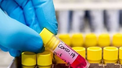 Tamil Nadu notifies 21 government hospitals exclusively for COVID-19 treatment