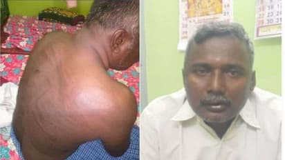 கள்ளக்காதலியின் கணவரிடம் சரமாரியாக அடிவாங்கிய அரசு ஊழியர்..! போலீசார் அடித்ததாக மனைவியிடம் நாடகம்..!