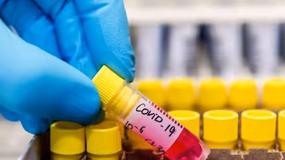 ಮಂಗಳೂರಿನ ಮೊದಲ ಕೊರೋನಾ ಸೋಂಕಿತ ಸಂಪೂರ್ಣ ಗುಣಮುಖ..!