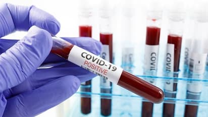 വീടുകള് കയറിയിറങ്ങി കൊവിഡ് വ്യാജ പരിശോധന; സൗദിയില് വിദേശികള് പിടിയില്