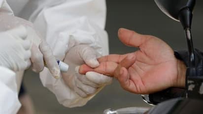 കൊവിഡ് 19 : രോഗം ഭേദമായവരുടെ ആന്റിബോഡി കൊണ്ടുള്ള ചികിത്സ 100 % ഫലപ്രദമെന്ന് ശാസ്ത്രജ്ഞര്‍