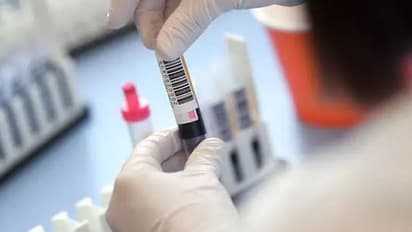 കൊവിഡ് 19; എന്താണ് കോണ്വാലസന്റ് പ്ലാസ്മ തെറാപ്പി ചികിത്സ..?