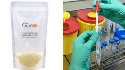 അണുബാധയുള്ള ശ്വസന സ്രവങ്ങള്‍ സുരക്ഷിതമായി കൈകാര്യം ചെയ്യാന്‍ സൂപ്പര്‍ അബ്‌സോര്‍ബന്റുമായി ശ്രീചിത്ര