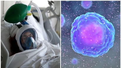 യുവാക്കളായ കൊവിഡ് രോഗികളെ ചതിക്കുന്നത് സ്വന്തം രോഗപ്രതിരോധവ്യൂഹമോ? അറിയാം സൈറ്റോക്കിൻസ്റ്റോം എന്ന പ്രതിഭാസത്തെ