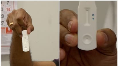 കൊവിഡ് 19 റാപിഡ് ആന്റിബോഡി ടെസ്റ്റ്; 20 മിനിറ്റിൽ ഫലമറിയാം, ആദ്യ പരിഗണന ആരോഗ്യപ്രവർത്തകർക്ക്