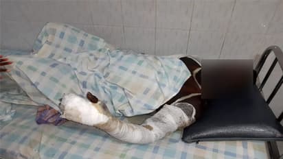 వివాహేతర సంబంధం... ప్రియుడిపై పెట్రోల్ పోసి నిప్పంటించిన ప్రియురాలు