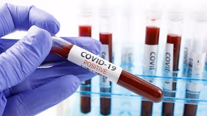 അഹമ്മദാബാദിൽ കൊവിഡ് ബാധിച്ച് മലയാളി മരിച്ചു