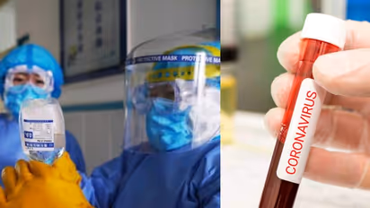 எடப்பாடி சொன்னா கேளுங்க... இப்போ சாப்பாடு கொடுத்த பெரியவருக்கு கொரோனா அட்டாக்..!