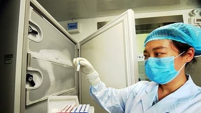 রাজ্যে শুরু হচ্ছে করোনার ব়্যাপিড টেস্ট, ১৪টি পরীক্ষাকেন্দ্রের মধ্য়ে আপনার কাছে কোনটি