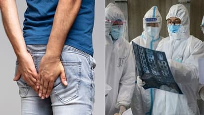 டேய் என்னடா சொல்றீங்க...  மனிதர்கள் வாயுவை வெளியேற்றினால் கொரோனா தொற்ற வாய்ப்பு..? ஆய்வில் அதிர்ச்சி..!