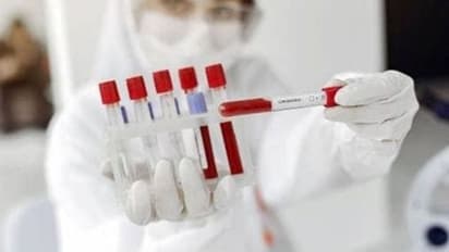 কোন পথে রোখা যাবে করোনার বৃদ্ধি, অঙ্ক কষে ব্যাখ্যা দিলেন বাঙালি বিজ্ঞানী