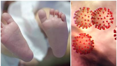 இதய நோயால் பாதிக்கப்பட்ட 4 மாதக் குழந்தை..! கொரோனாவிற்கு பலியான சோகம்..!