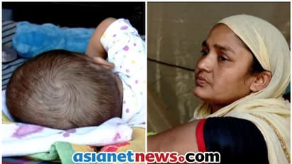 ഒടുവിൽ അയന് ആശ്വാസം; ചികിത്സയ്ക്കായി എത്തി ലോക്ക് ഡൗണിൽ കുടുങ്ങിയ കുഞ്ഞിനെ എയിംസിൽ അഡ്മിറ്റ് ചെയ്യും