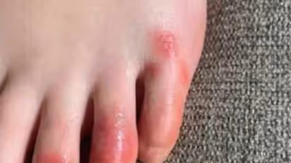 ಜ್ವರ, ಕೆಮ್ಮು ಮಾಯ: ಹೊಸ ರೂಪದಲ್ಲಿ ಕೊರೋನಾ, ಎಚ್ಚರ!