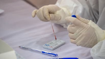 കൊവിഡ് 19: കോഴിക്കോട്ടെ ഹോട്ട്സ്പോട്ടുകളിൽ നിന്ന് 359 സാംപിളുകള്‍ പരിശോധനയ്ക്ക് അയച്ചു