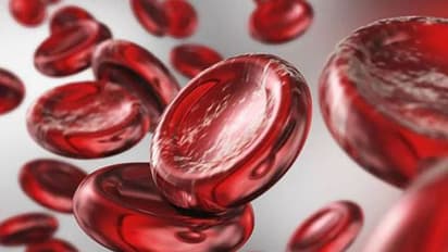 রক্তে হিমোগ্লোবিনের মাত্রার ঘাটতি রয়েছে, বুঝে নিন এই লক্ষণগুলি দেখে