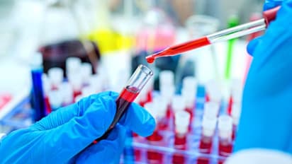 മഹാരാഷ്ട്രയിൽ ആദ്യമായി പ്ലാസ്മാ തെറാപ്പി നടത്തിയ കൊവിഡ് രോഗി മരിച്ചു