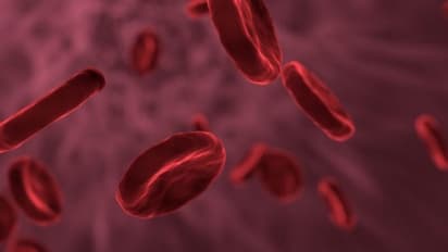 കൊറോണ വൈറസ് രക്തക്കുഴലുകളെയും ആക്രമിക്കാം; പുതിയ പഠനം