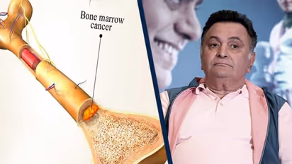 ২ বছর লড়াইয়ের পর হার মানলেন ক্যান্সারের কাছে, চিনে নিন এই ভয়াবহ মারণব্যাধিকে