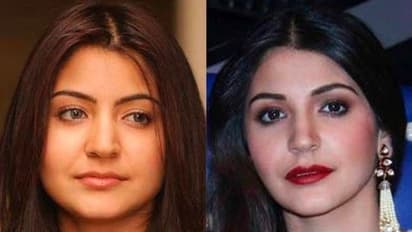 "তোমার মধ্যে কনও সৌন্দর্য নেই", এই মন্তব্যের কারণেই কি লিপ ফিলারের সহায় হন অনুষ্কা