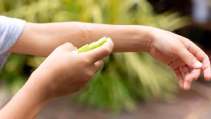 Mosquito menace: Make your own night-time mosquito repellent with just 2 ingredients