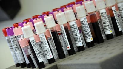 প্লাজমা থেরাপিতে ভরসা রাখতে চান গবেষকরা, করোনা সংক্রমণ রুখতে কার্যকর বলেও দাবি