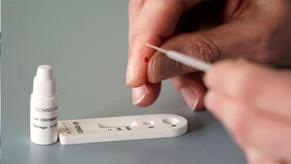 মাত্র ৫০০ টাকাতেই করোনা পরীক্ষা, দেড় ঘন্টায় রিপোর্ট জানাবে কলকাতার এই সংস্থার টেস্ট কিট