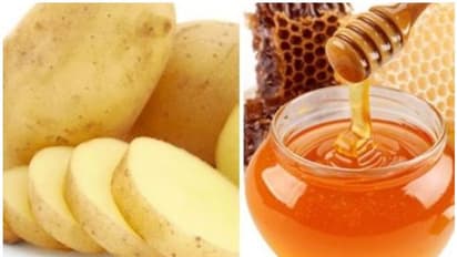 മുഖത്തെ കറുപ്പകറ്റാൻ ഉരുളക്കിഴങ്ങ് കൊണ്ടുള്ള അഞ്ച് തരം ഫേസ് പാക്കുകൾ