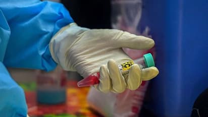 'ಕೊರೋನಾಗೆ ಔಷಧಿ ಕಂಡು ಹಿಡಿಯಲು ಕನಿಷ್ಠ 10 ವರ್ಷಗಳಾದ್ರೂ ಬೇಕು'..! ಕನ್ನಡಿಗ ಕೆನಡಾ ವಿಜ್ಞಾನಿ ಹೇಳಿದ್ದಿಷ್ಟು