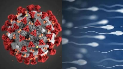 കൊവിഡ് ബാധിതരുടെ ശുക്ലത്തില് കൊറോണ വൈറസ് സാന്നിധ്യം; ചൈനീസ് പഠനം