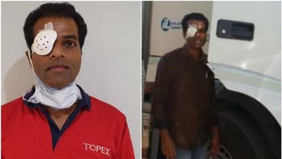 കണ്ണില് പിന് തറച്ചത് മൂലമുണ്ടായ പരിക്കുമായി കാത്തിരുന്നത് ഒരു മാസത്തിലേറെ; മലയാളി യുവാവ് ഇന്ന് നാട്ടിലേക്ക്