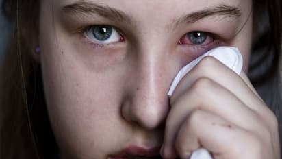 मुंह में निवाला डालते ही आंखों से बहने लगते हैं आंसू, दुनियाभर में सिर्फ 95 लोग इस सिंड्रोम से पीड़ित