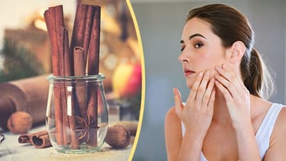একটুকরো দারুচিনিতে বদলে যাবে ত্বকের সৌন্দর্য, জানুন কীভাবে