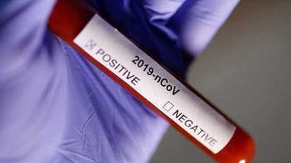 ఏపీలో తగ్గని కరోనా విజృంభణ: కేసుల సంఖ్య 2339, మొత్తం మరణాలు 52