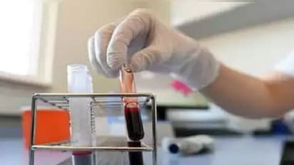 3 వేలు క్రాస్ చేసిన తెలంగాణ: కొత్తగా 129 మందికి పాజిటివ్, హైదరాబాద్లో 108 కేసులు