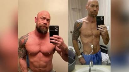 'കൊറോണ വരുത്തിയ മാറ്റം'; ഞെട്ടിക്കുന്ന ഫോട്ടോകള് പങ്കുവച്ച് രോഗത്തില് നിന്ന് രക്ഷപ്പെട്ടയാള്...