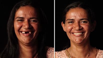 പാവപ്പെട്ടവരുടെ തൊണ്ണുകൾക്കും പുഞ്ചിരിപ്പല്ലുകൾ നൽകി 'വ്യത്യസ്തനായ' ഒരു ദന്തഡോക്ടർ: ചിത്രങ്ങൾ കാണാം